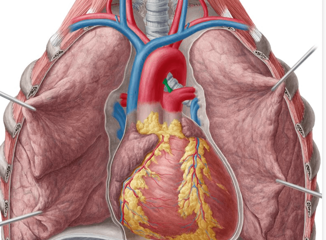 Anterior thoracic anatomy showing the ligamentum arteriosum highlighted in green between the aortic arch and pulmonary artery.
